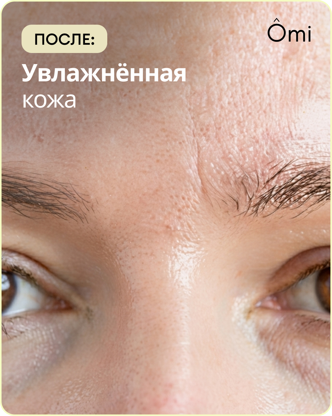 После: увлажнённая кожа