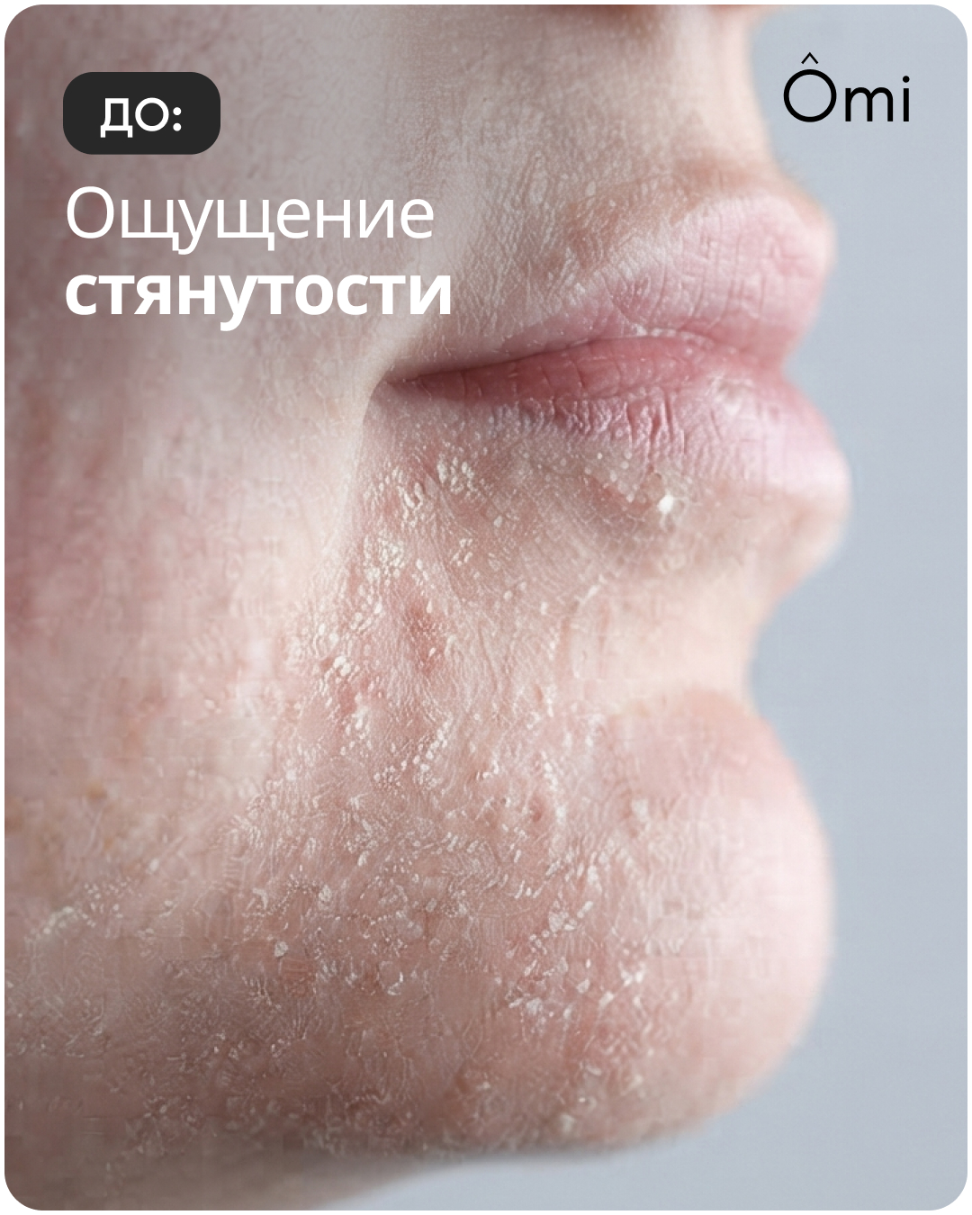 До: ощущение стянутости