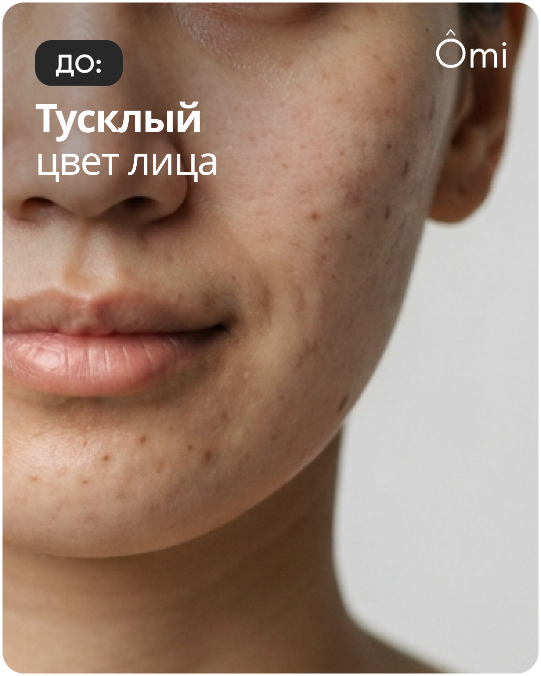 До: тусклый цвет лица