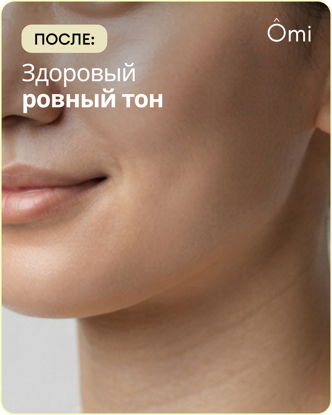 После: здоровый ровный тон